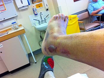 Click image for larger version

Name:	ouch2.JPG
Views:	158
Size:	107.6 KB
ID:	1254378